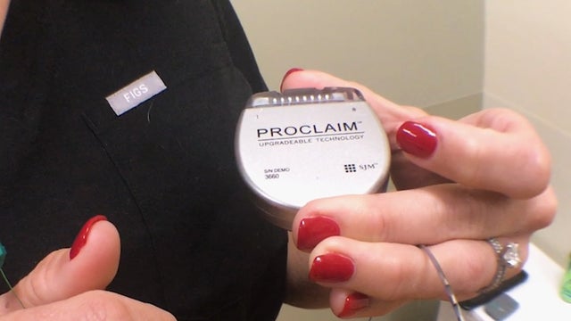 'It's amazing': Florida man among the first to receive new implant that gets rid of pain