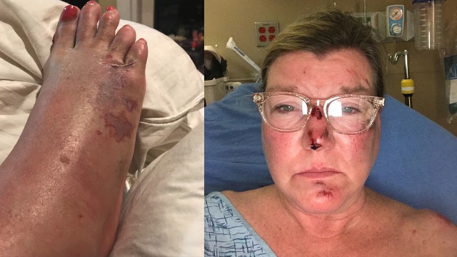 Woman says she encountered burglar inside home before being attacked by intruder