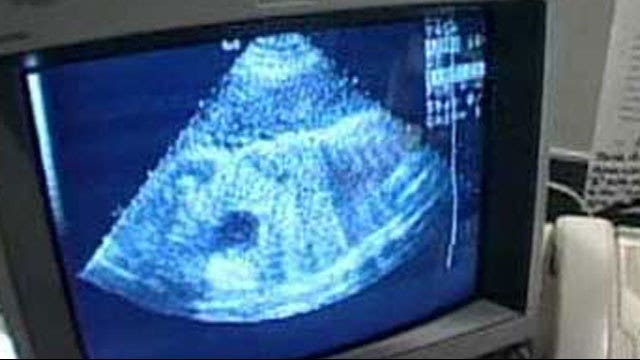 Florida Senate poised to take up parental consent