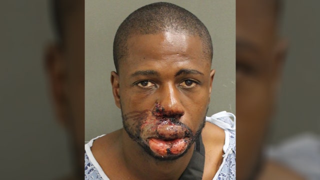 Second suspect in Orlando officer-involved shooting released from hospital