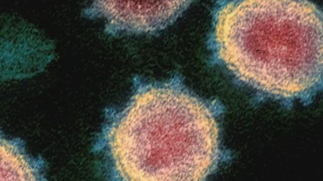 Reports show millennials can have severe, possibly deadly reactions to coronavirus too