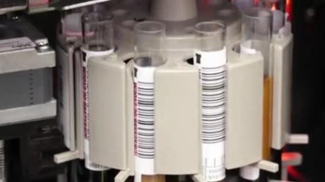 Want to know if you had COVID-19? OneBlood will test all donated blood for antibodies