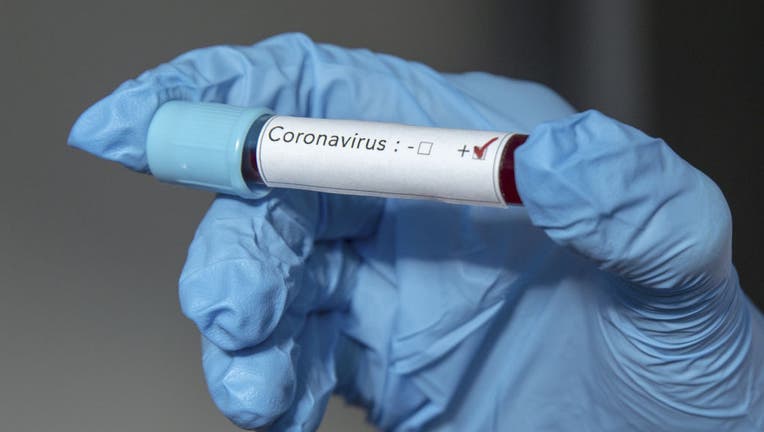 19708155-Coronavirus (2019-nCoV)