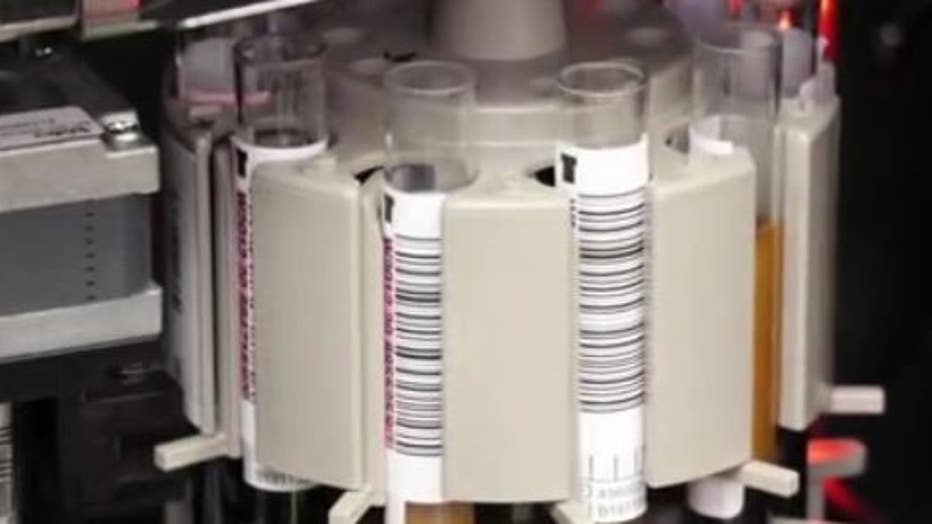blood testing
