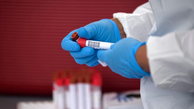 FDOH cuts ties with Quest Diagnostics after company fails to report 75,000 COVID-19 test results