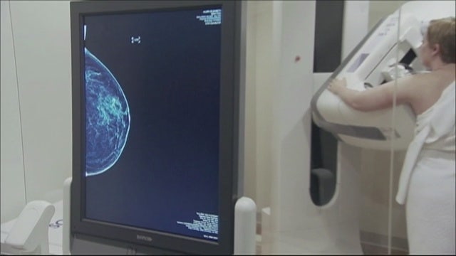 Women are getting less mammograms, doctors think it may be COVID-19 related