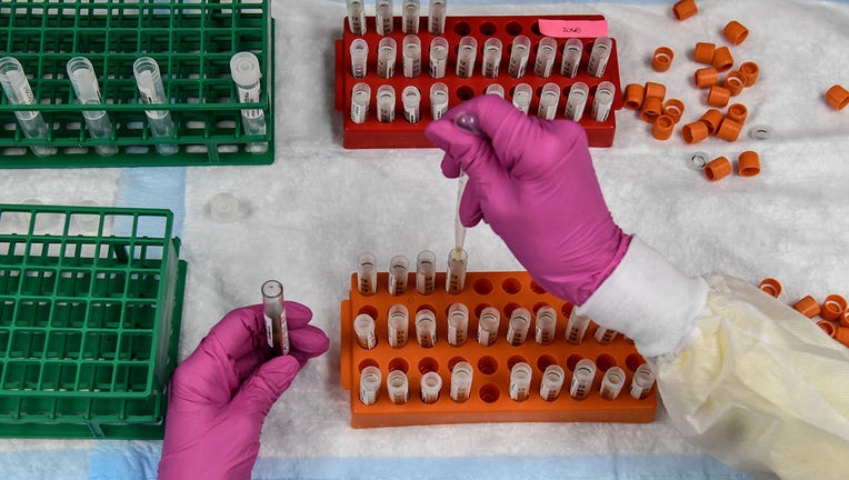 US-HEALTH-VIRUS-VACCINE-TRIALS