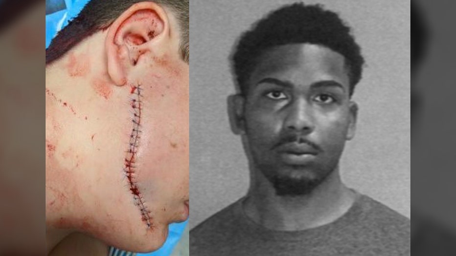 face slashing attack nathaniel peoples