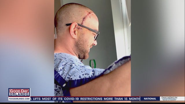 Ocoee Fire Department goes above and beyond to help firefighter with brain tumor