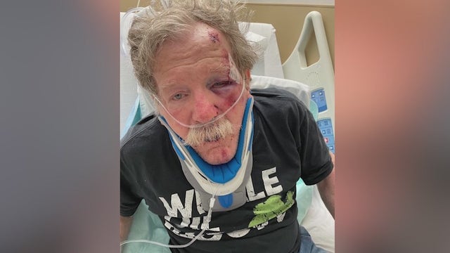 Good Samaritans credited for saving man with Parkinson’s