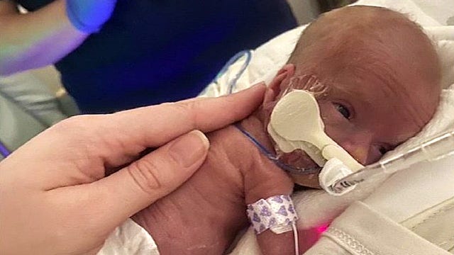 Support pouring in for Brevard family as micro-preemie Nola continues health battle