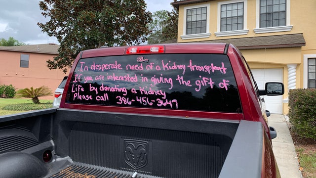 Florida man going to extreme measures in search for a kidney for wife