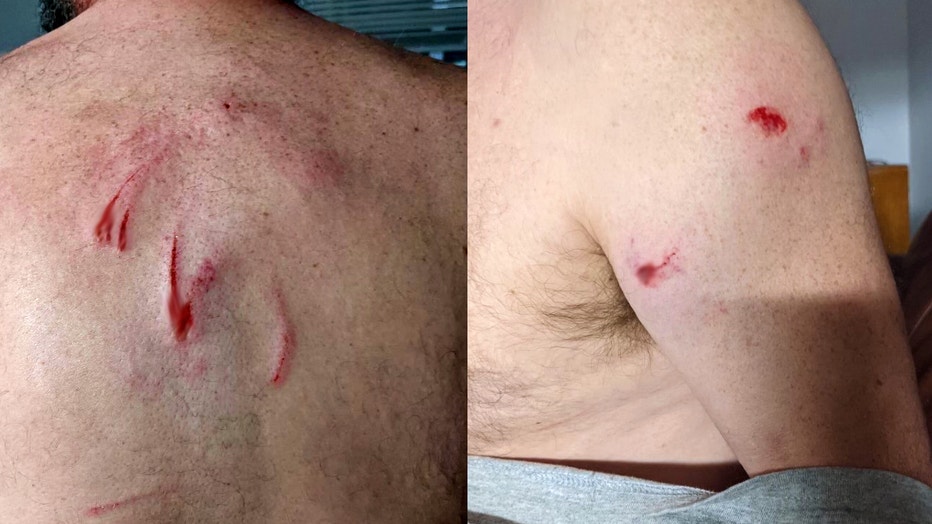 Daytona bear attack injuries