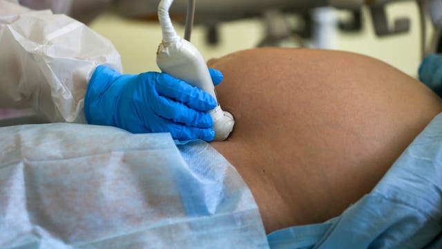 Florida House passes bill banning abortions after 15 weeks