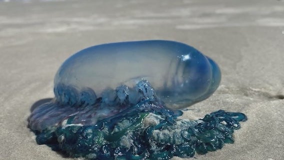 Toxic Portuguese man o' war popping up on Florida beaches: What to know