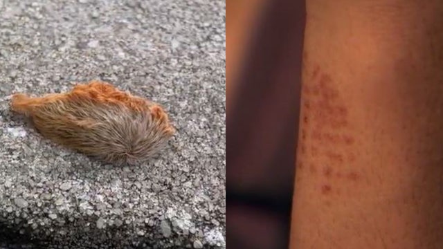 Venomous puss caterpillars in Florida: What to do if you get stung