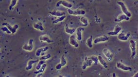 Brain-eating amoeba: Where it lives, symptoms, and how to avoid being infected
