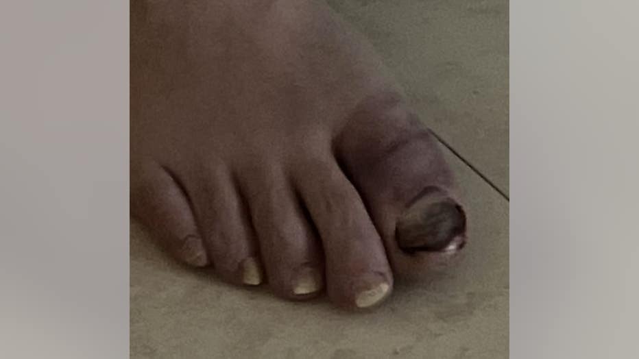 husband-foot.jpg